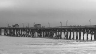 AGAが安定したら植毛のタイミング｜AGA進行止め→植毛の最適フロー