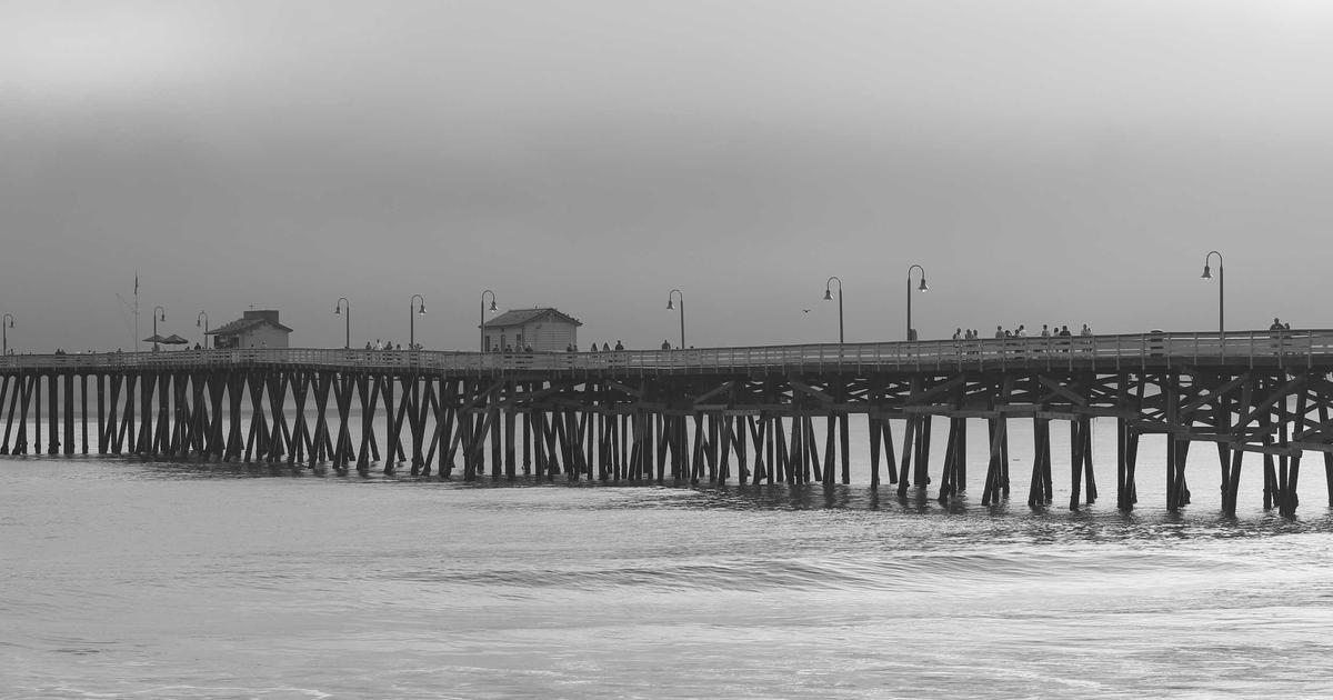 AGAが安定したら植毛のタイミング｜AGA進行止め→植毛の最適フロー