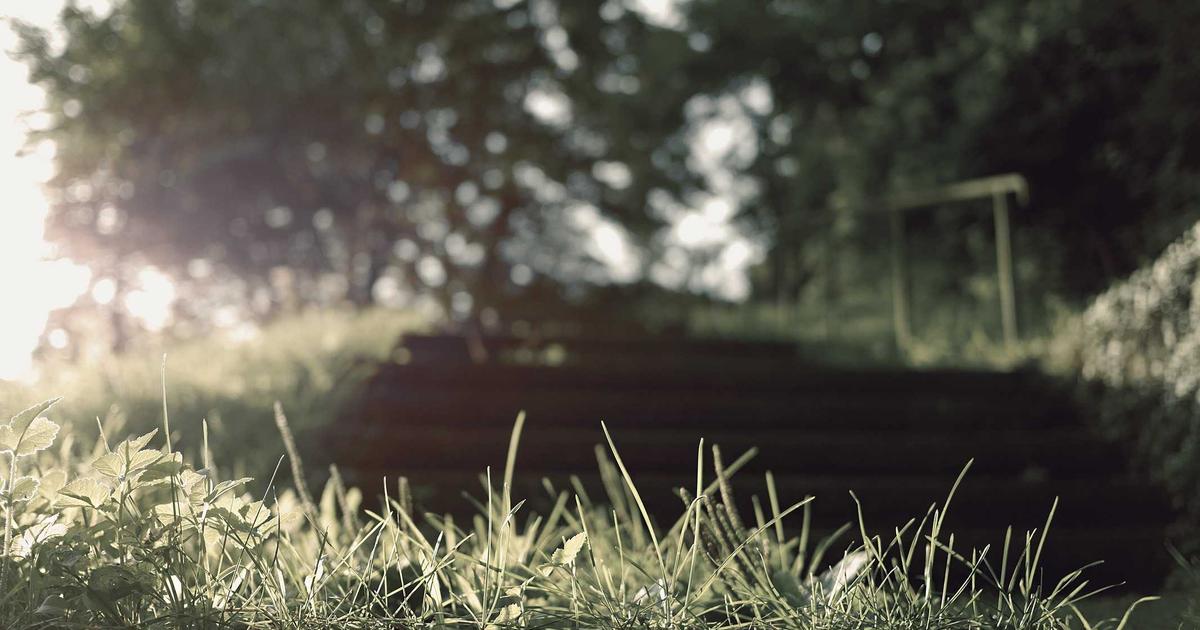 若年性AGA（20代前半）への植毛：早期治療のメリット・デメリット