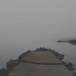 植毛で生え際を完全回復|AGAによるM字・O字・U字の完全回復プラン