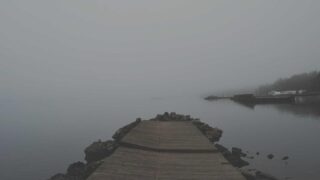 植毛で生え際を完全回復｜AGAによるM字・O字・U字の完全回復プラン