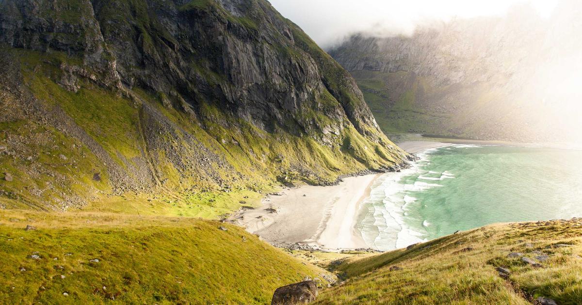 植毛手術 毛髪移植