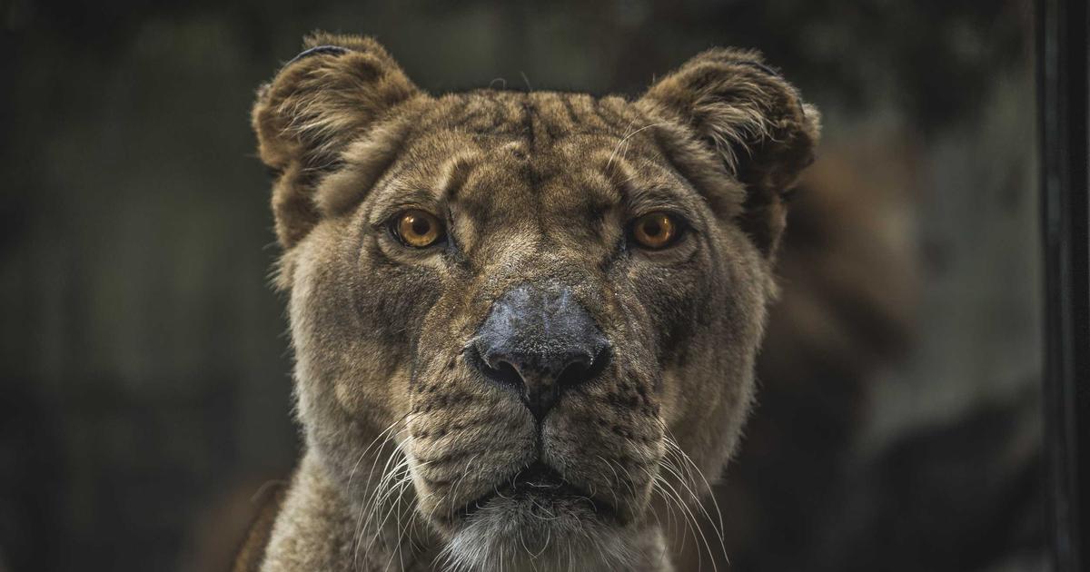 植毛手術 毛髪移植