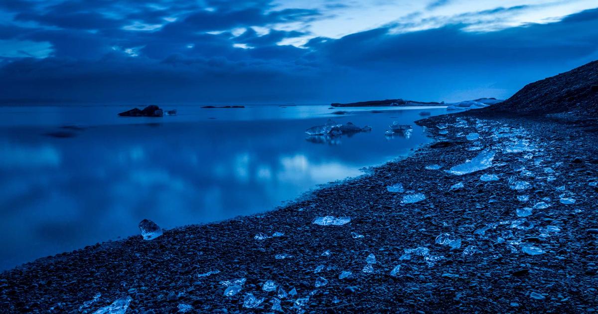 植毛手術 毛髪移植