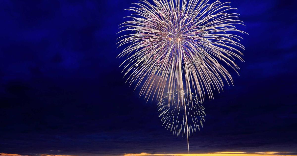 髪の毛移植 ヘアトランスプラント