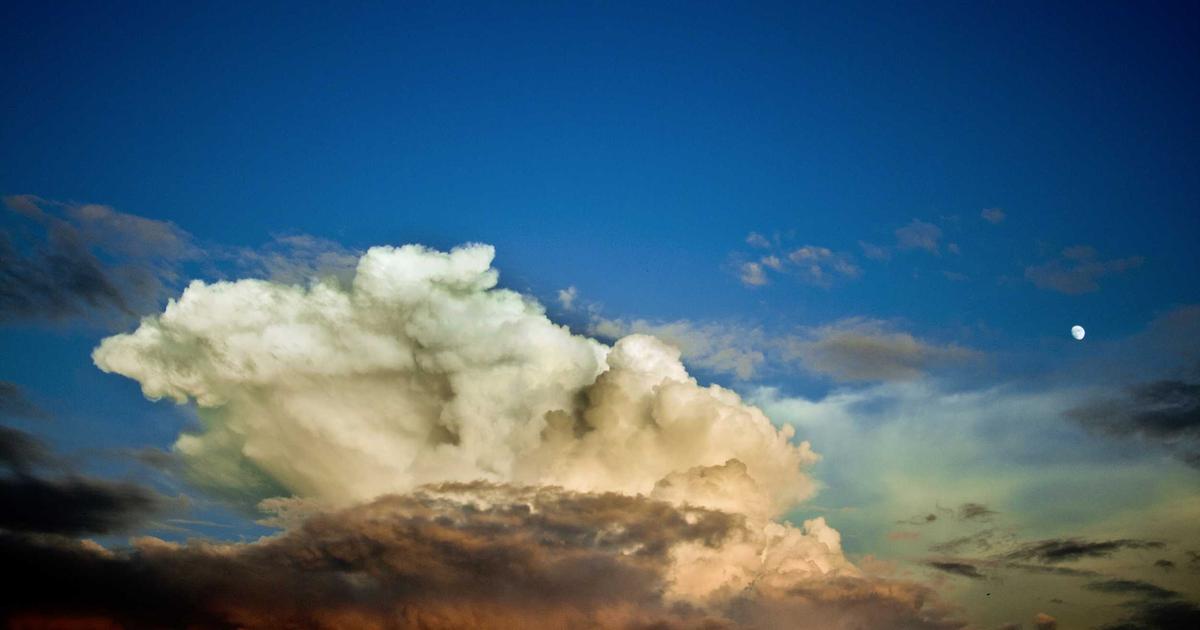 髪の毛移植 ヘアトランスプラント