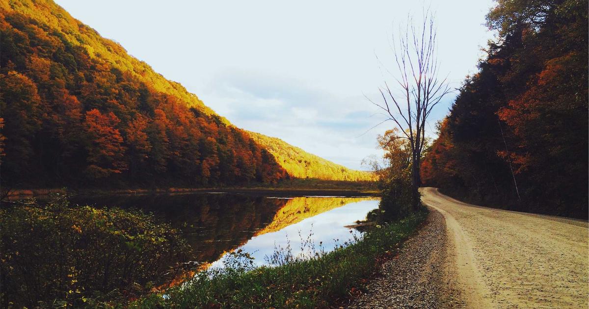 髪の毛移植 ヘアトランスプラント