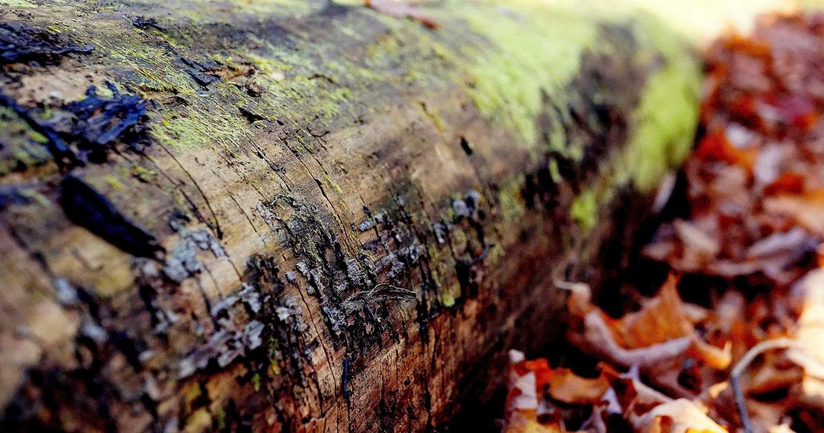 髪の毛移植 ヘアトランスプラント