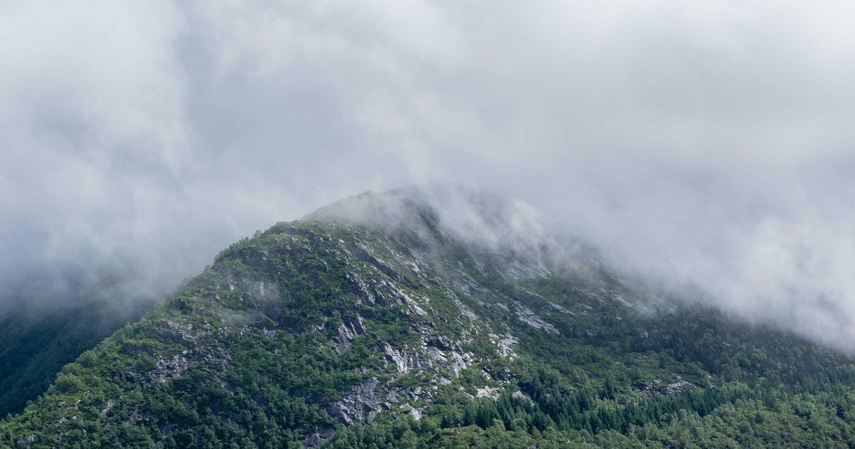 薄毛 若者 ヘアケア