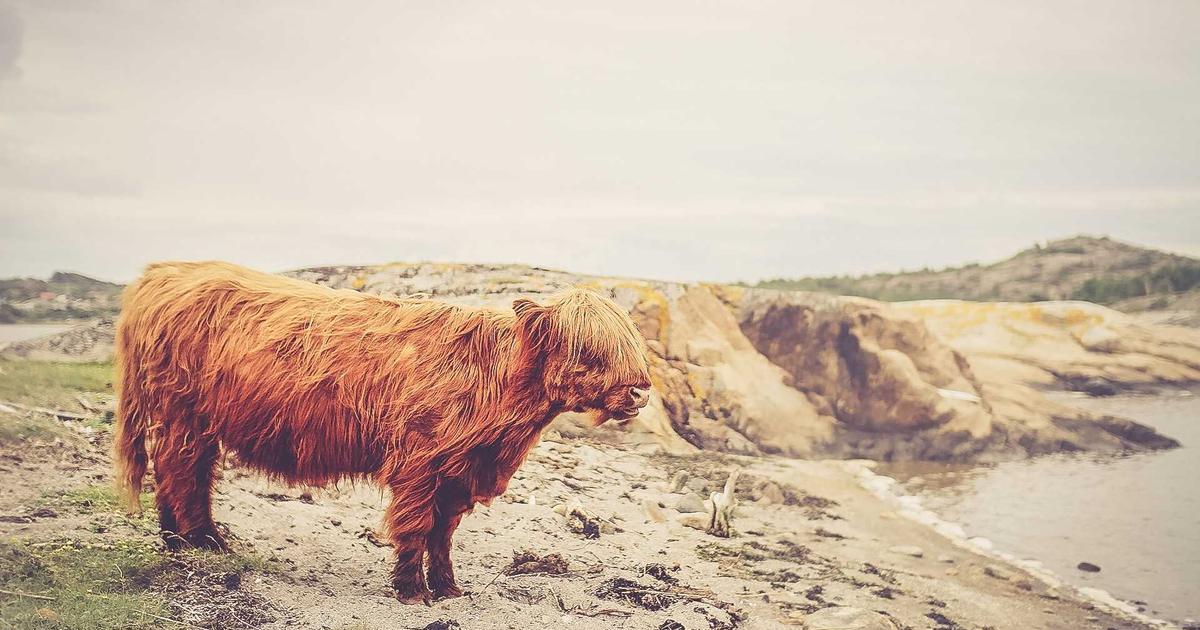 M字はげ 植毛 生え際