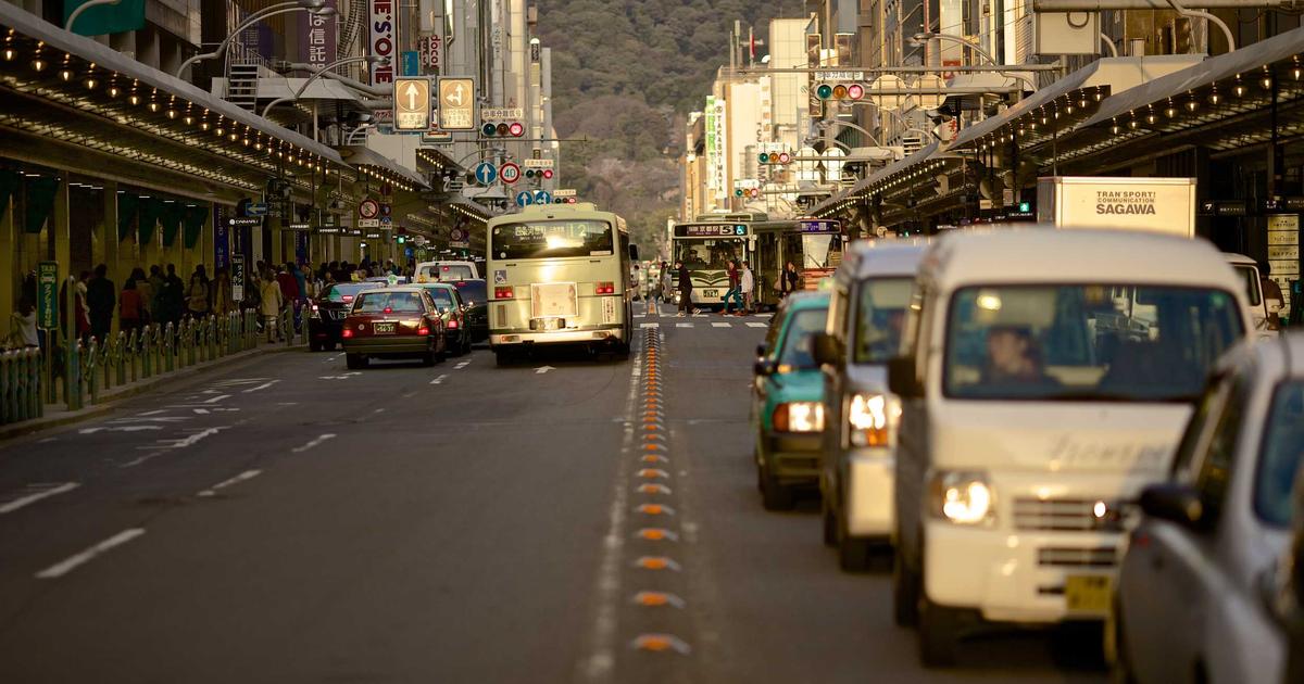 M字はげ 植毛 生え際