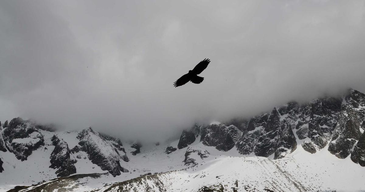 M字はげ植毛のリスク・後悔談｜失敗しないための注意点