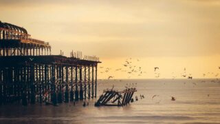 M字植毛の適応条件｜ドナー毛の量・頭皮状態の判断基準