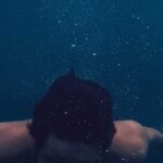 M字植毛の手術時間｜グラフト数別の所要時間と当日の流れ