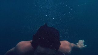 M字植毛の手術時間｜グラフト数別の所要時間と当日の流れ