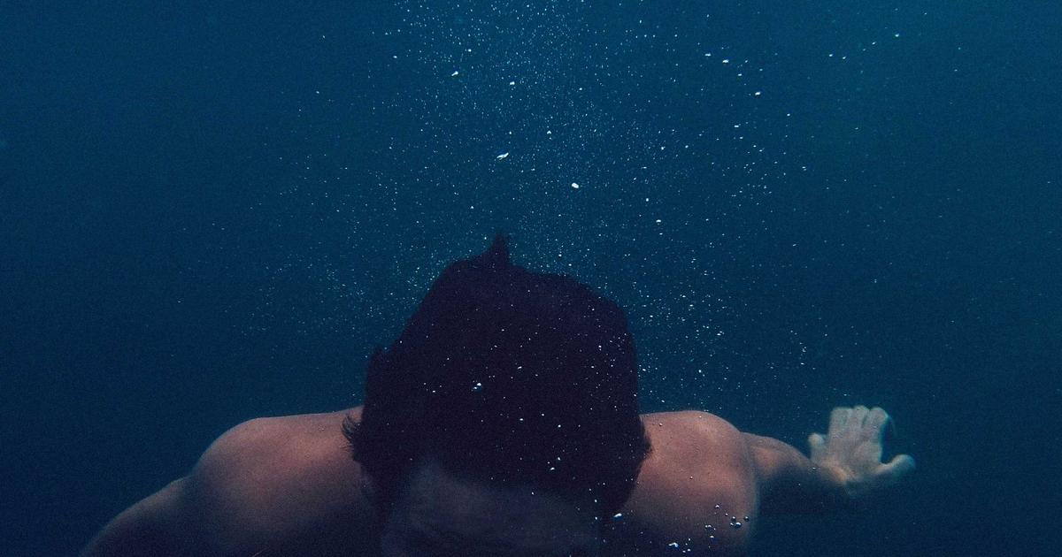 M字 植毛 クリニック