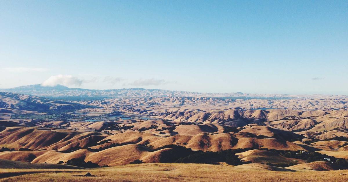 M字 植毛 クリニック