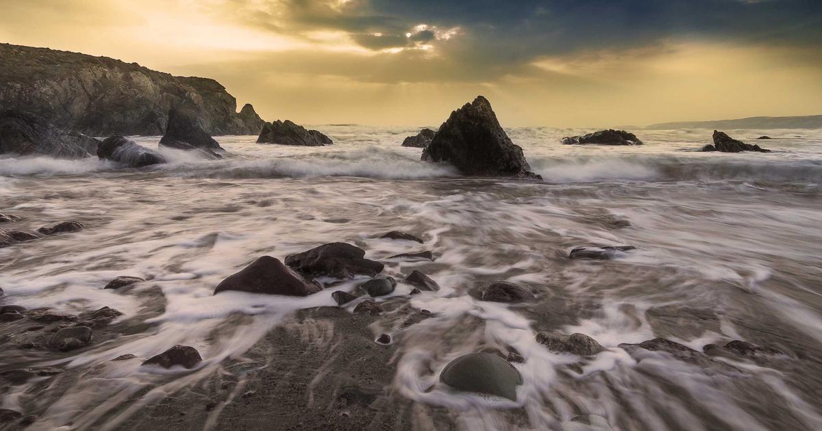 前髪 生え際 植毛