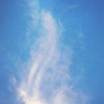 前髪植毛 vs ヘアライン形成術｜どちらを選ぶべき？徹底比較