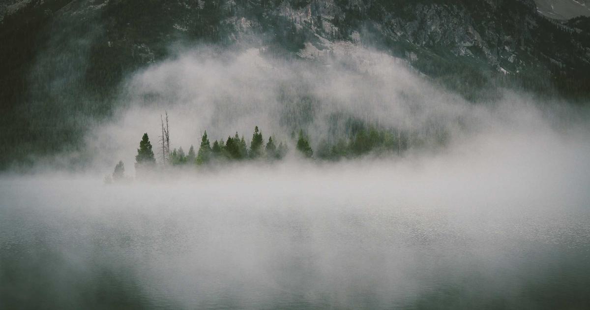 前髪 生え際 植毛