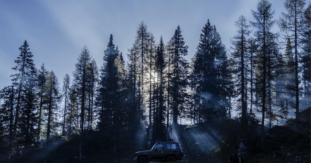 FUT 植毛手術 クリニック