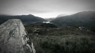 植毛クリニックの無料カウンセリングを活用する方法｜聞くべき質問15選【2026年】