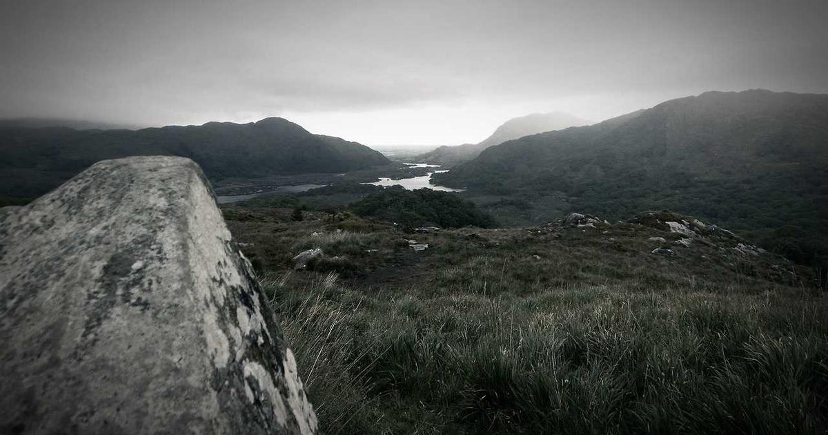 植毛クリニックの無料カウンセリングを活用する方法｜聞くべき質問15選