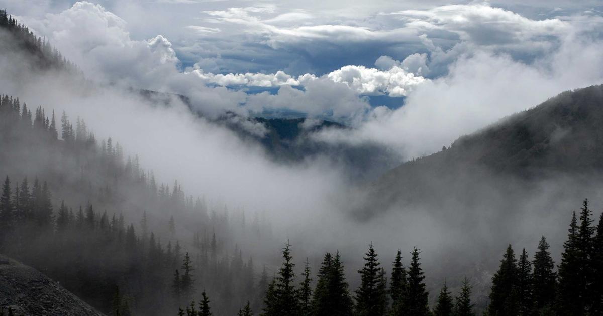 植毛手術の費用を安くする方法｜モニター・キャンペーン・医療ローン活用術