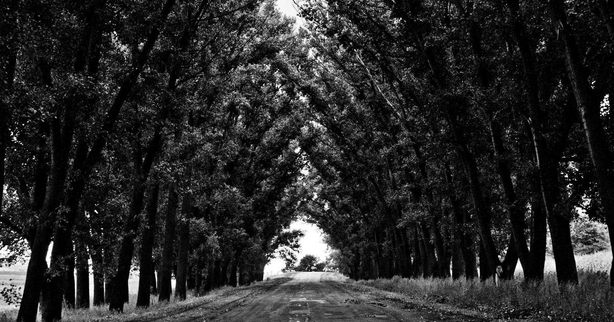 植毛3000グラフトの費用はいくら？広範囲薄毛への植毛料金完全ガイド