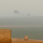 植毛費用の相場一覧【2026年版】｜薄毛タイプ別の費用目安