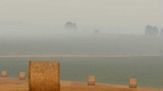 植毛費用の相場一覧【2026年版】｜薄毛タイプ別の費用目安