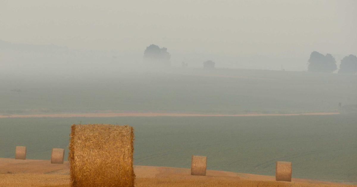 植毛費用の相場一覧【2026年版】｜薄毛タイプ別の費用目安