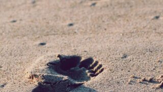 海外植毛と国内植毛の費用比較｜トルコ植毛は本当に安い？