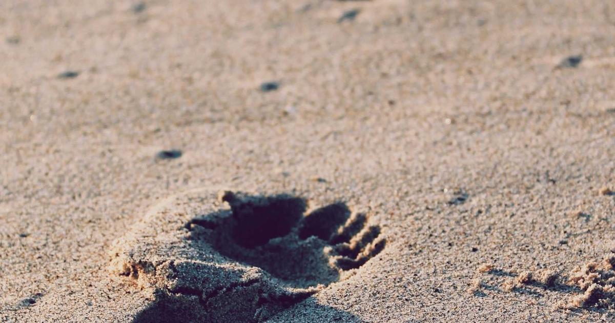 海外植毛と国内植毛の費用比較｜トルコ植毛は本当に安い？