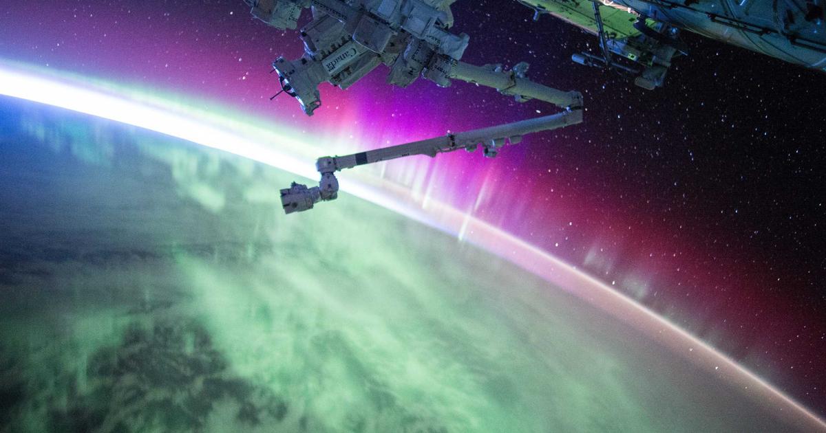 50代・60代の植毛｜高齢者の植毛リスク・適応条件・注意点