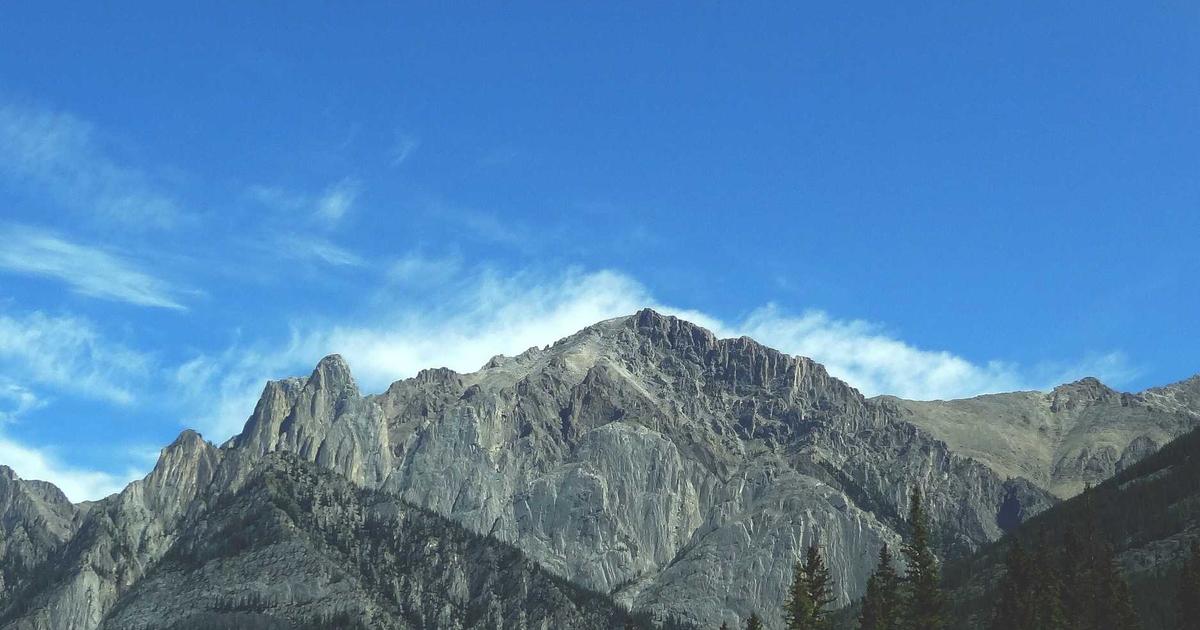 会社員・サラリーマンの植毛｜仕事を休まず植毛する方法