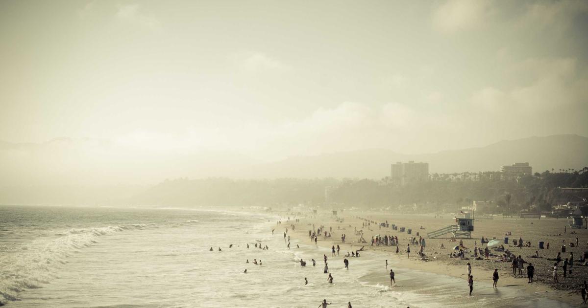 転職前・就職前の植毛｜面接に間に合う？タイムラインで解説