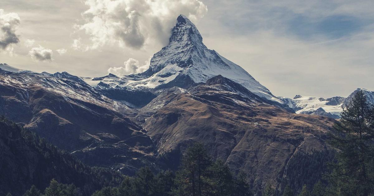 植毛後1ヶ月の経過報告｜シェディング前後の変化と生活制限解除