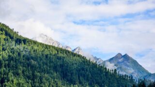 植毛 vs デュタステリド（ザガーロ）：重度AGAへの最適治療戦略