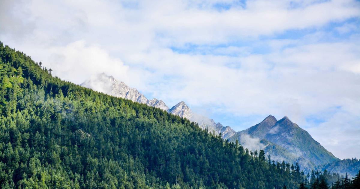 植毛 vs デュタステリド（ザガーロ）：重度AGAへの最適治療戦略