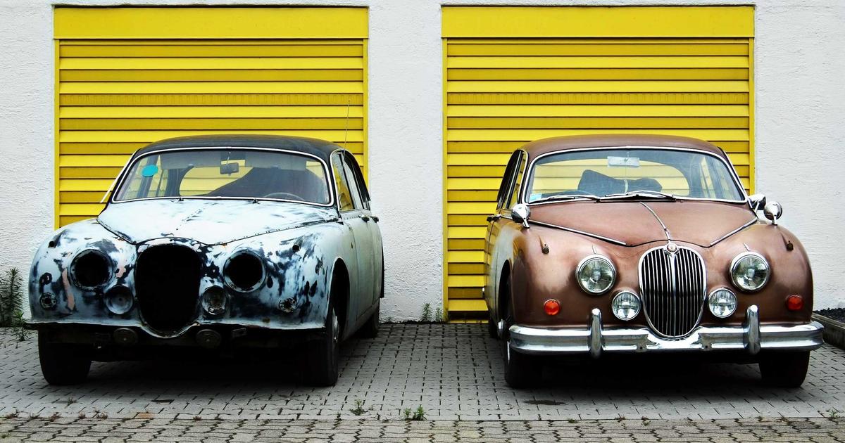 植毛 vs ヘアタトゥー：最新のヘアライン修正技術比較