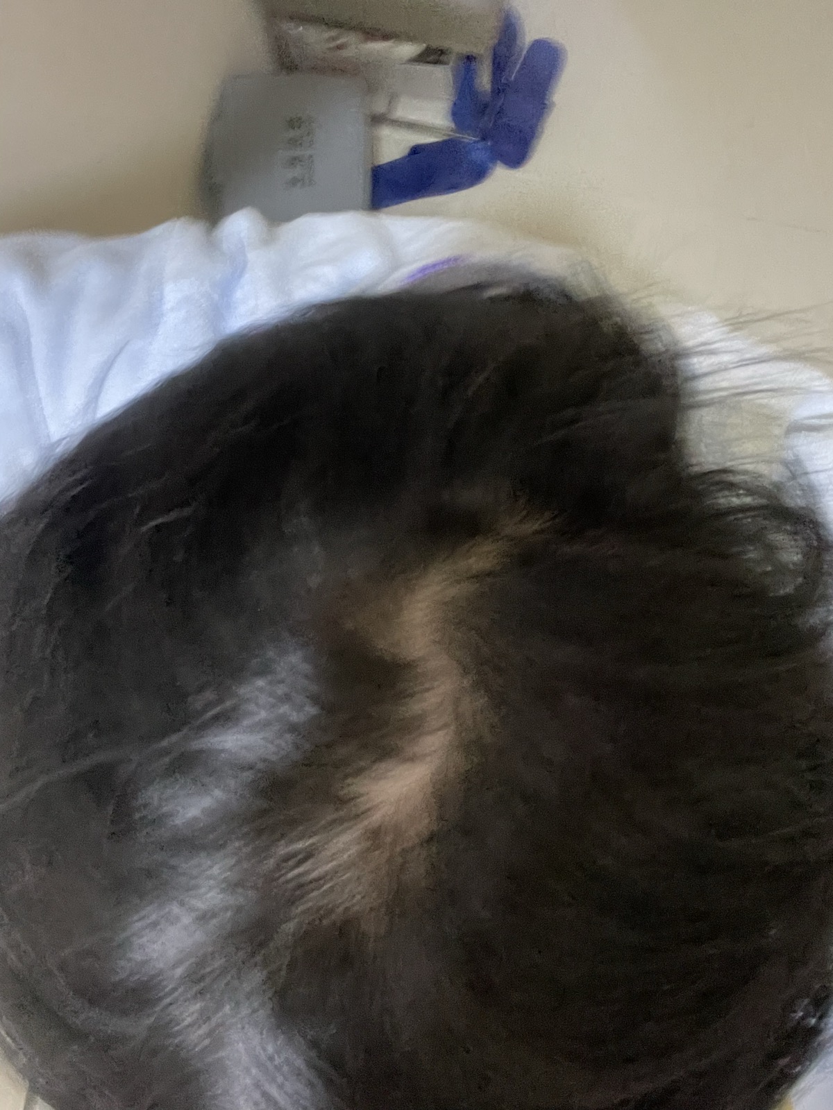 アフターケアスプレー（Forsmile）