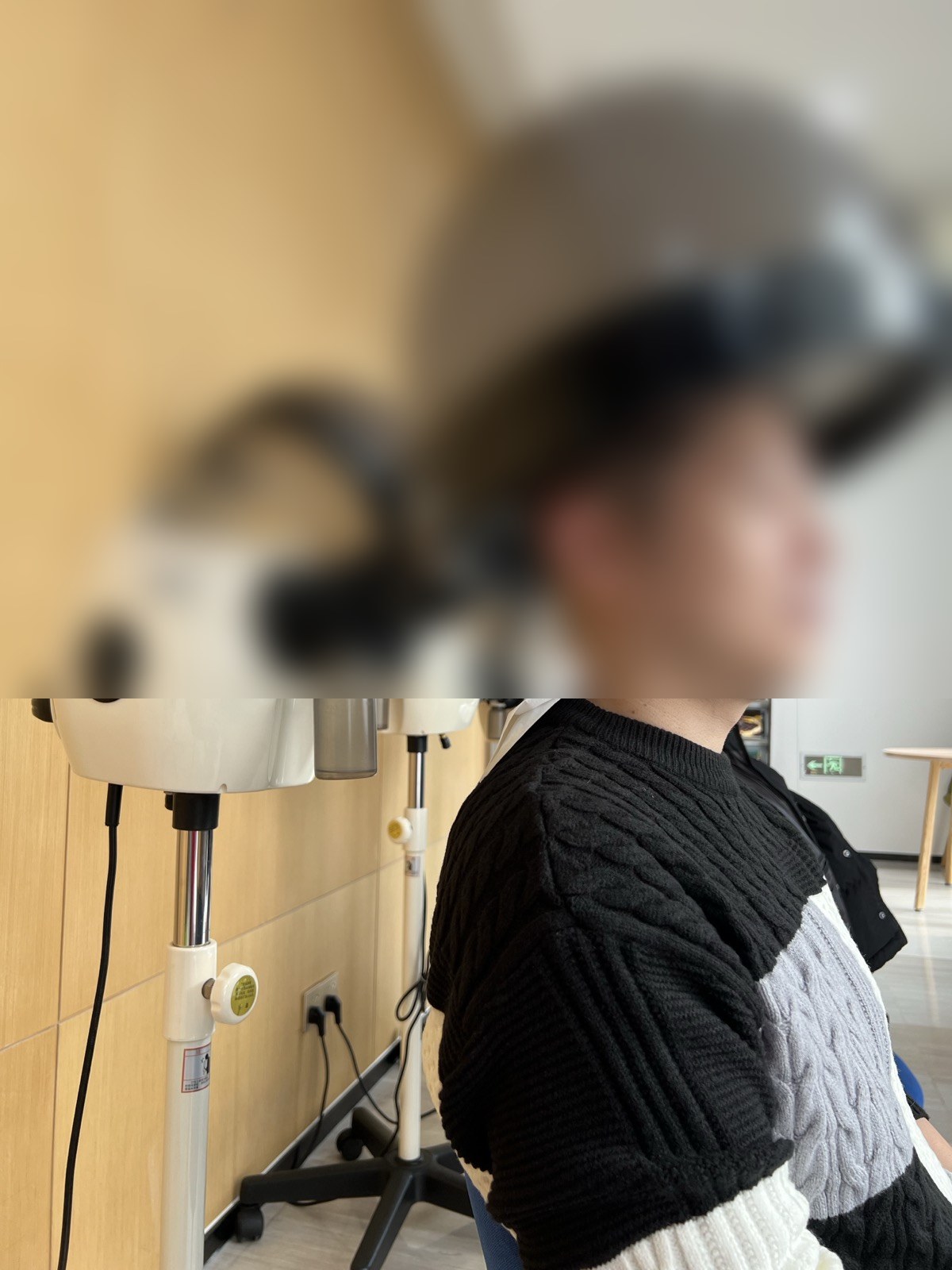 術後8日目・治療機器によるケア（顔ぼかし済み）