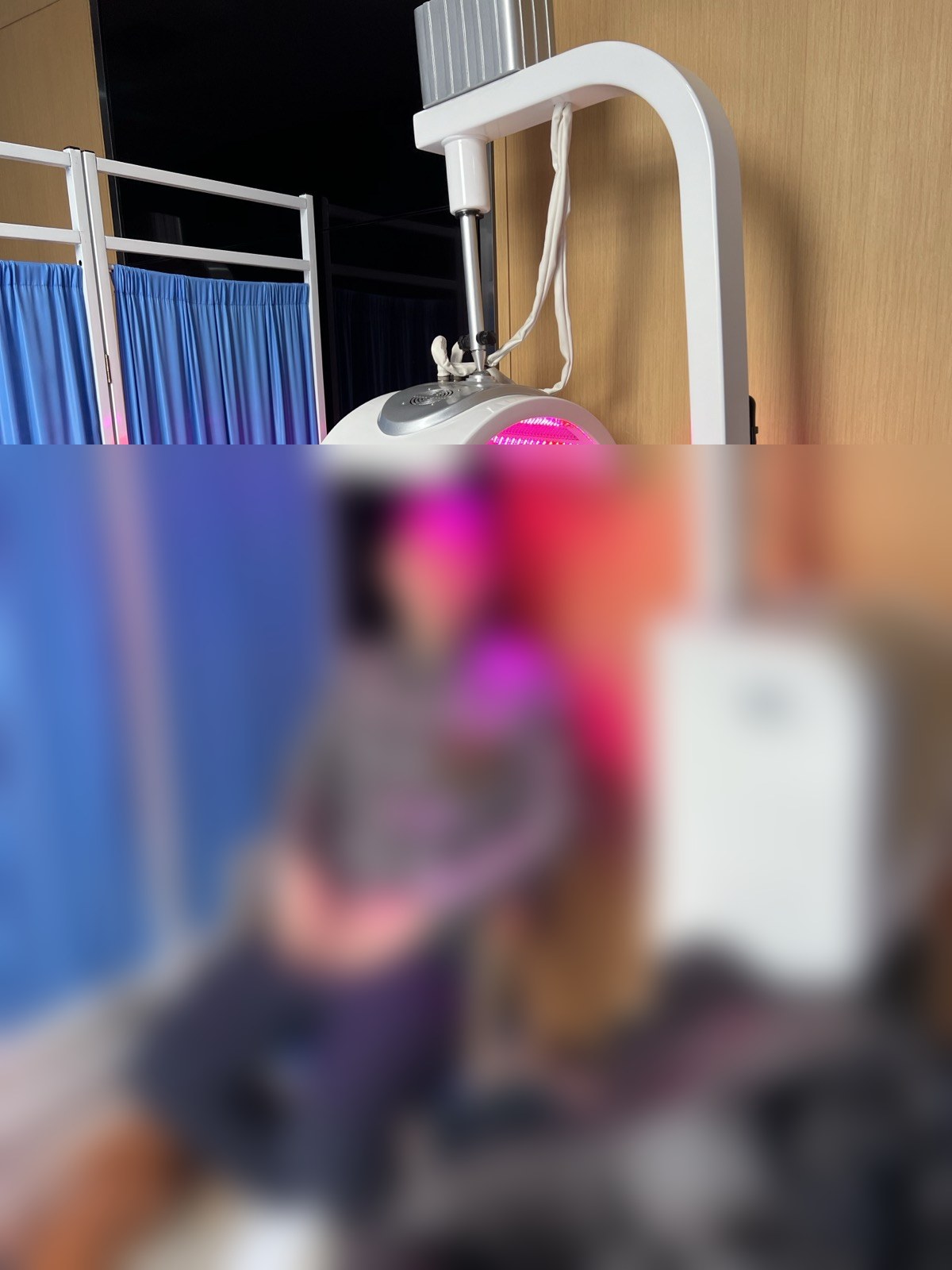 術後8日目・光線療法（顔ぼかし済み）