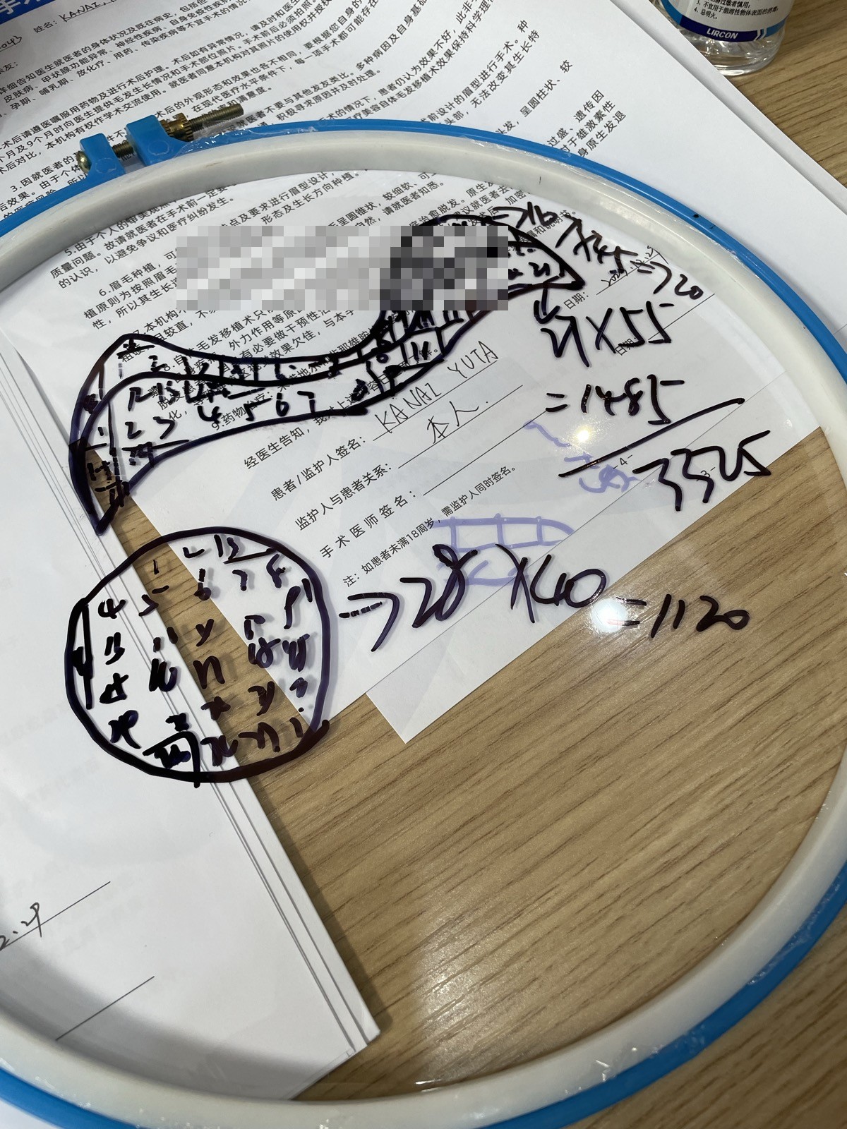 ヘアラインデザイン確認書（個人情報ぼかし済み）