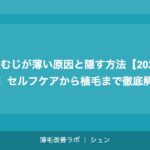 つむじが薄い原因と隠す方法【2026年】セルフケアから植毛まで徹底解説