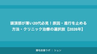 頭頂部が薄い20代必見！原因・進行を止める方法・クリニック治療の選択肢【2026年】