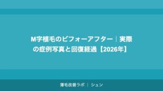 M字植毛のビフォーアフター｜実際の症例写真と回復経過【2026年】