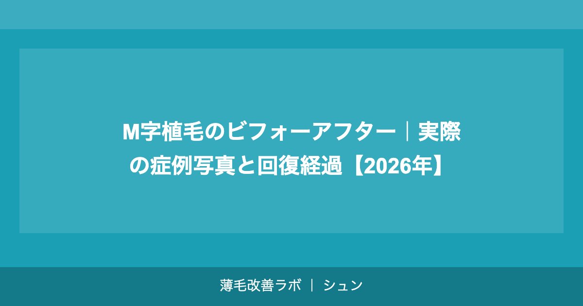 M字植毛のビフォーアフター｜実際の症例写真と回復経過【2026年】