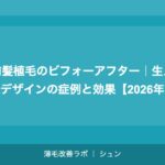 前髪植毛のビフォーアフター｜生え際デザインの症例と効果【2026年】